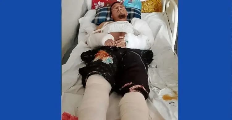 যুবককে ৫ তলা থেকে ফেলে দেন স্ত্রী-শ্যালক, ভেঙেছে হাত-পা ও কোমরের হাড়